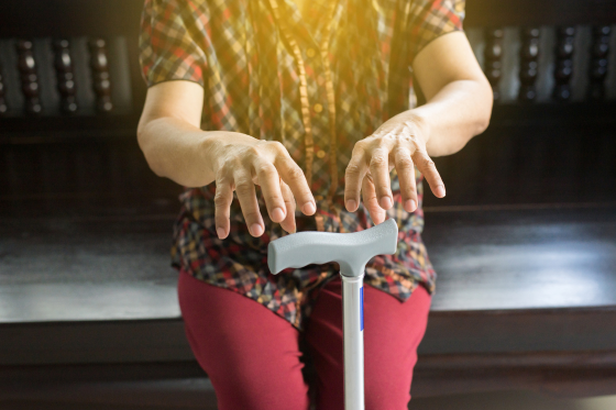 A woman struggles with balance and falls due to Parkinson's Disease